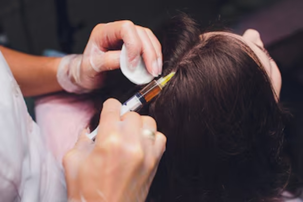 Stem Cell Therapy for Hair Loss